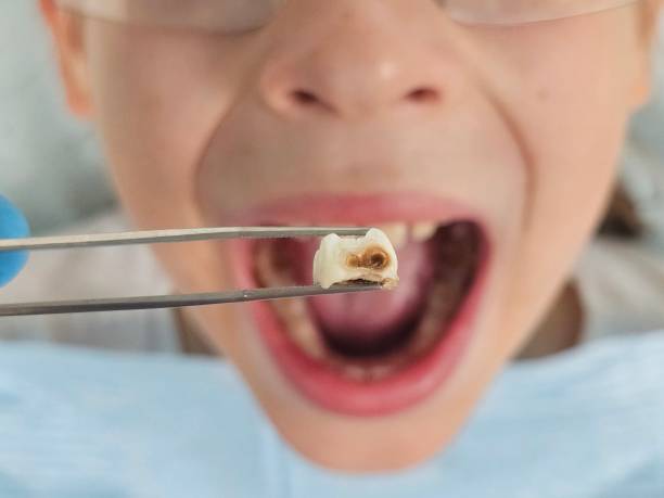 Best Emergency Dental Surgery in Stevensville, MI